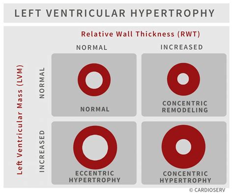 left ventricular mass index chart.